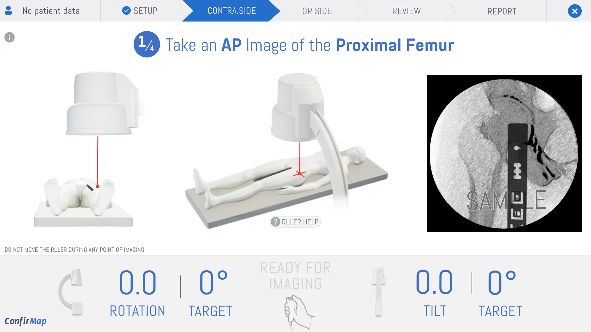 Torus Biomedical Solutions screenshot 4