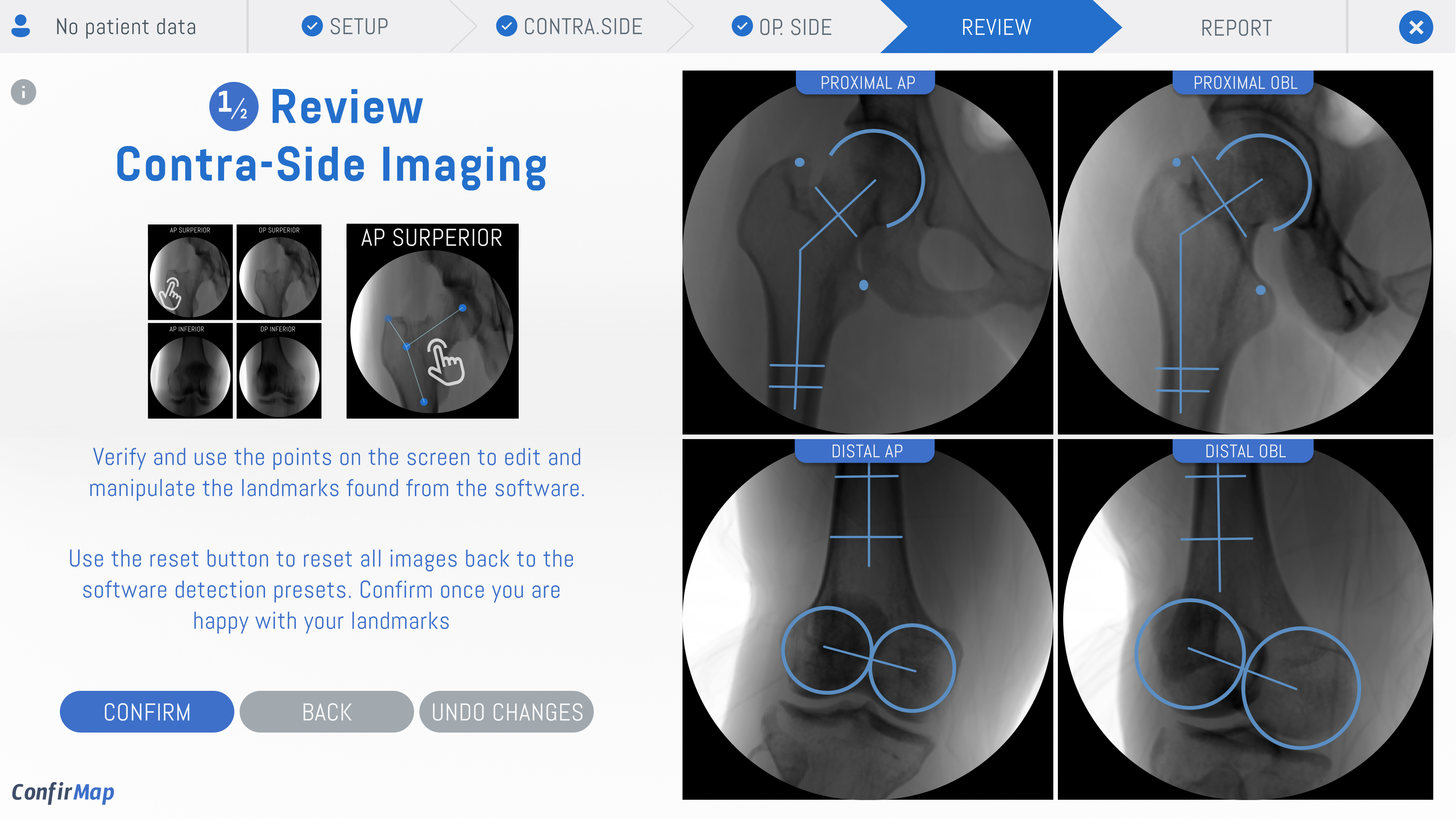 Torus Biomedical Solutions screenshot 5